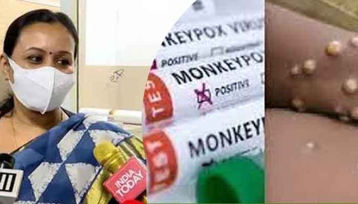 മങ്കിപോക്സ്: ആദ്യ രോഗി രോഗമുക്തി നേടി