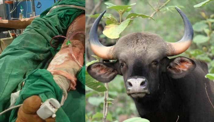 വനംവകുപ്പ് വാച്ചർക്ക് കാട്ടുപോത്തിന്റെ ആക്രമണത്തിൽ പരുക്കേറ്റു